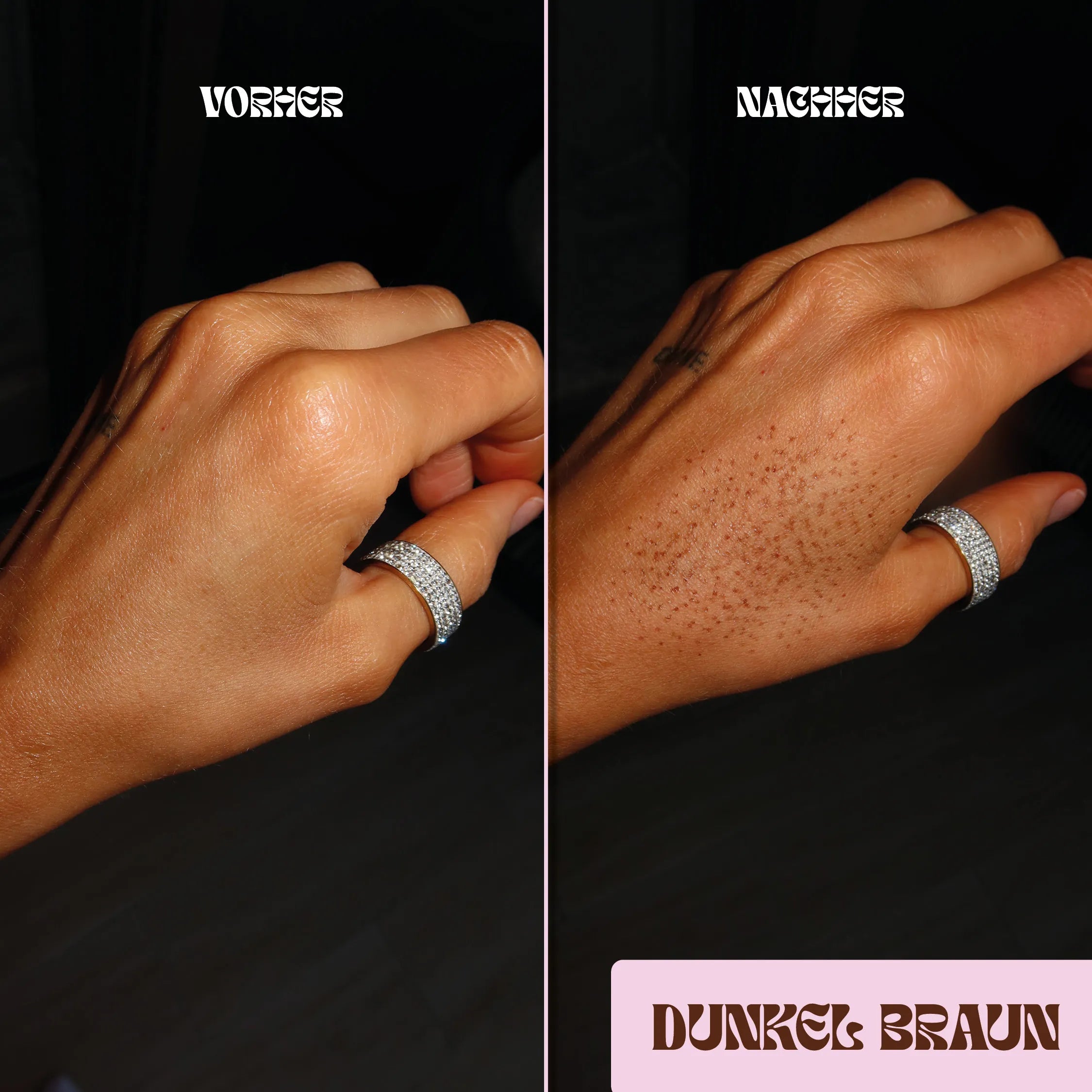 Freckles Dunkel Braun auf der Hand